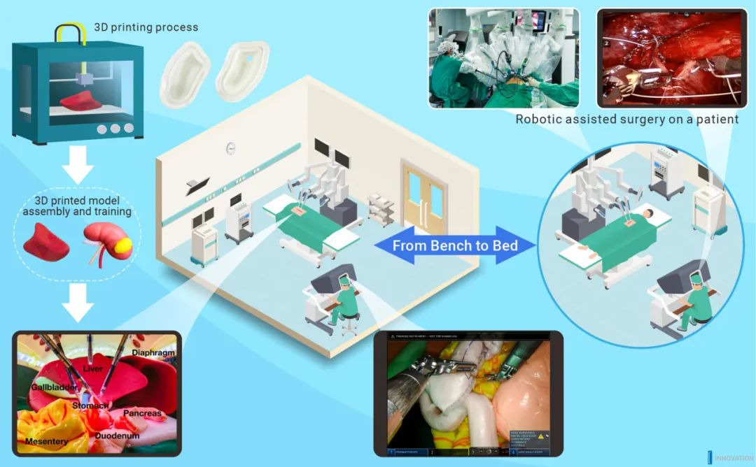  로봇 보조 수술 및 3D 프린팅 모델